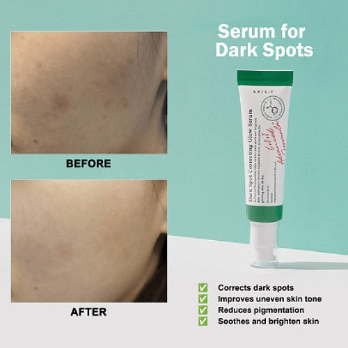 Axis-Y Dark Spot Correcting Glow Serum (5)