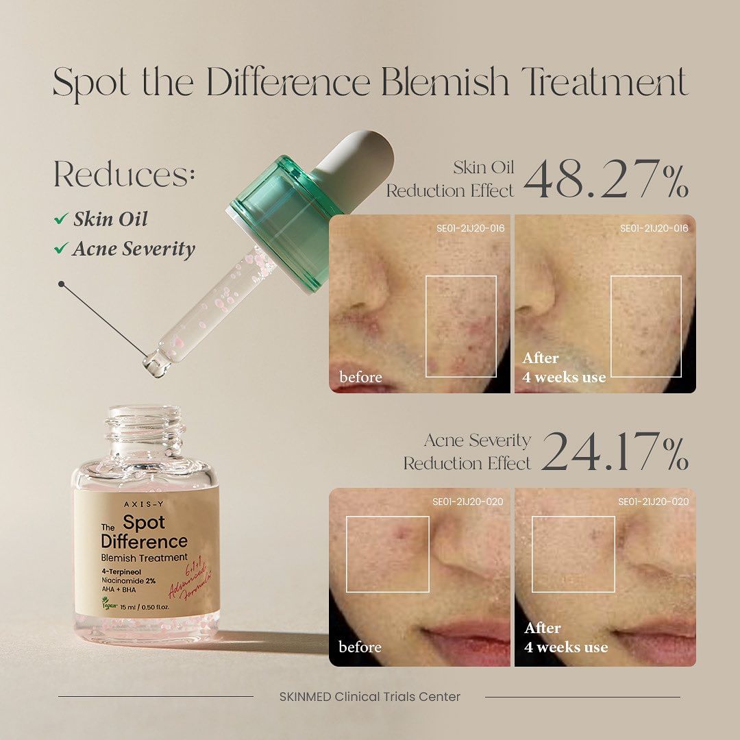 Axis Y Difference Blemish Treatment anti blemish and acne serum (1)